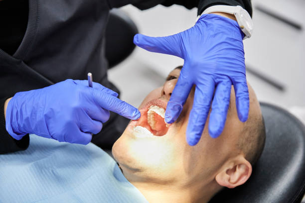 Best Emergency Wisdom Teeth Removal in Blairsville, PA
