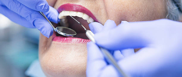 Best Emergency Wisdom Teeth Removal in Blairsville, PA